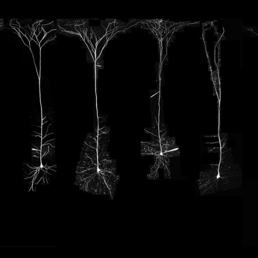 Caption:MIT neuroscientists analyzed neurons from several different species.