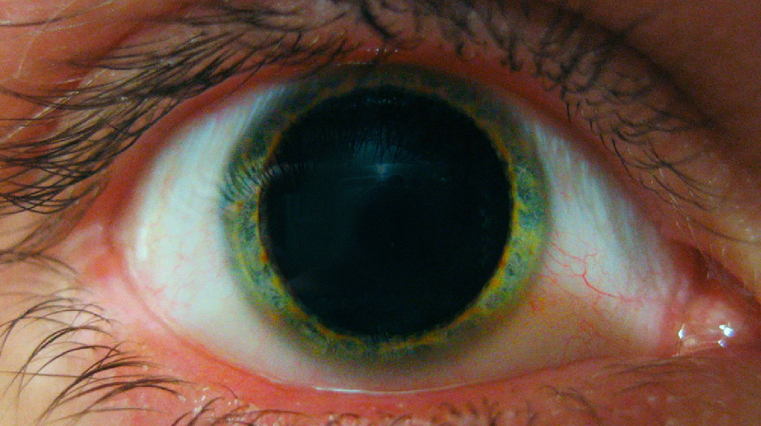 How psychedelics work