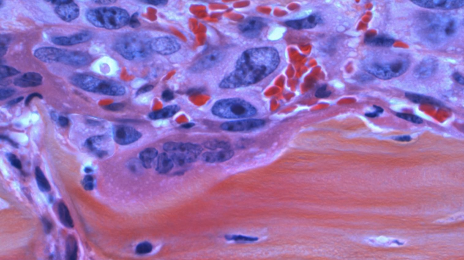 a close up of a piece of skin.