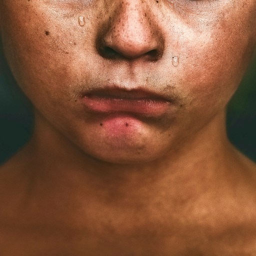 a close up of a person with freckles on his face.