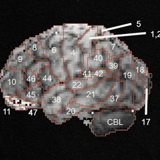 A pixelated image depicting the structure of a human brain.