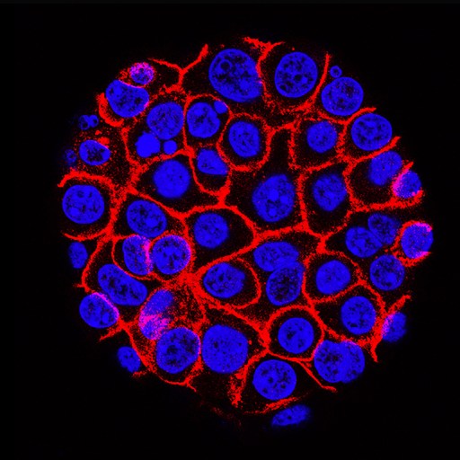 An image of a pancreatic cell in a dark room.