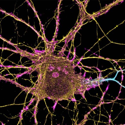 A picture of a neuron with blue and yellow lights.