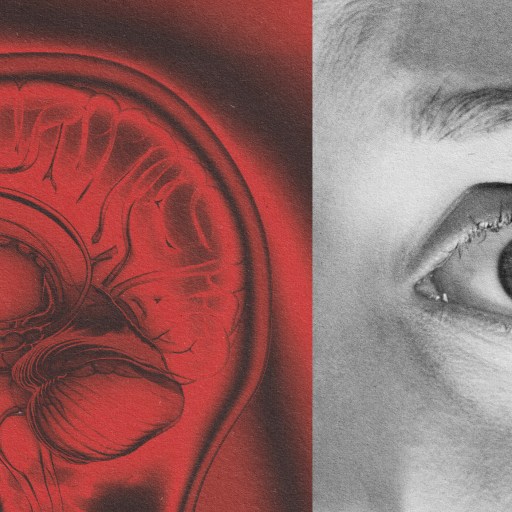 An image of a woman's eye exhibiting signs of amygdala hijack.