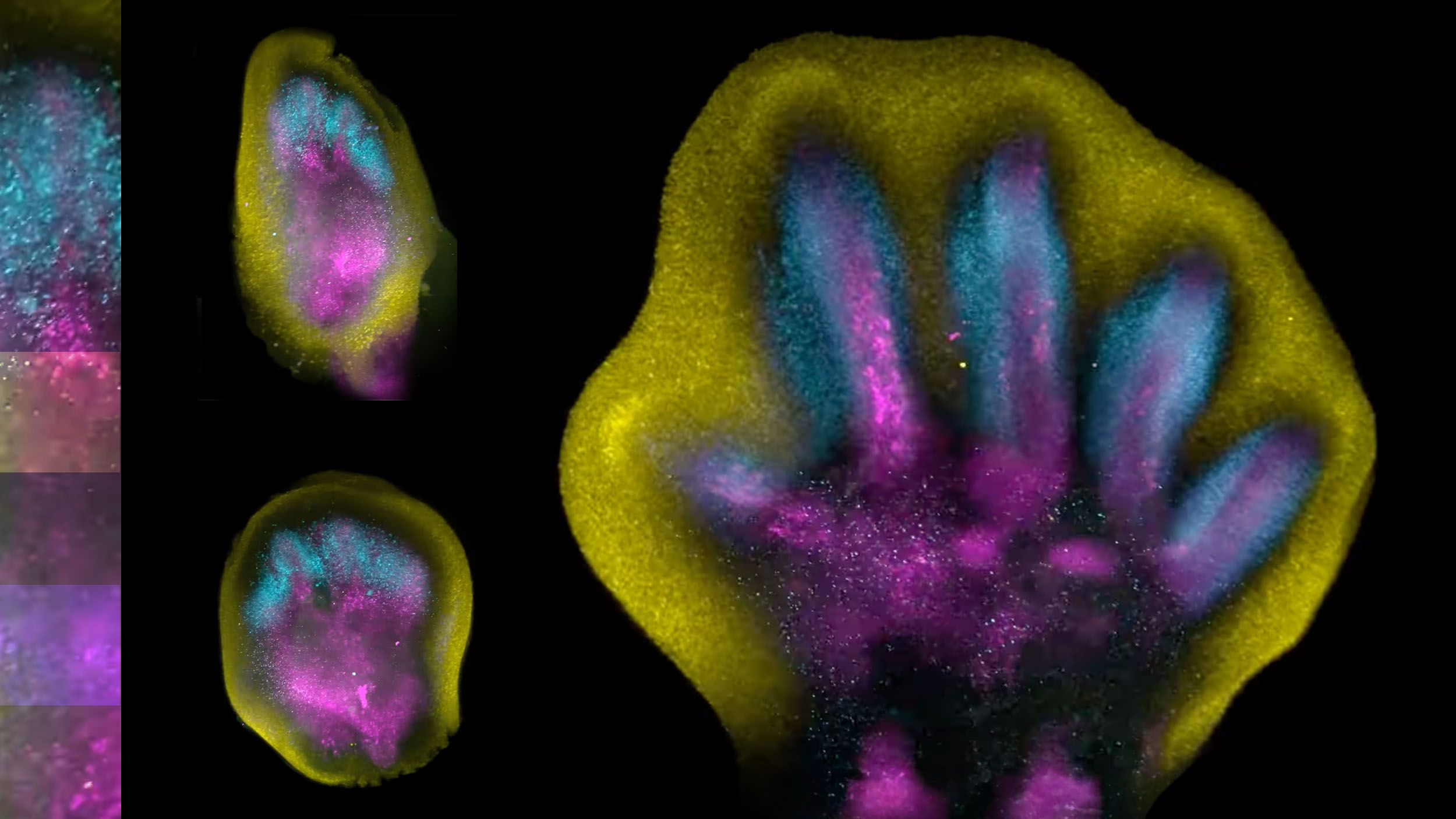 Fingers forming in the womb