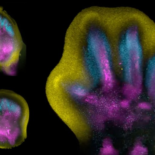 Fingers forming in the womb