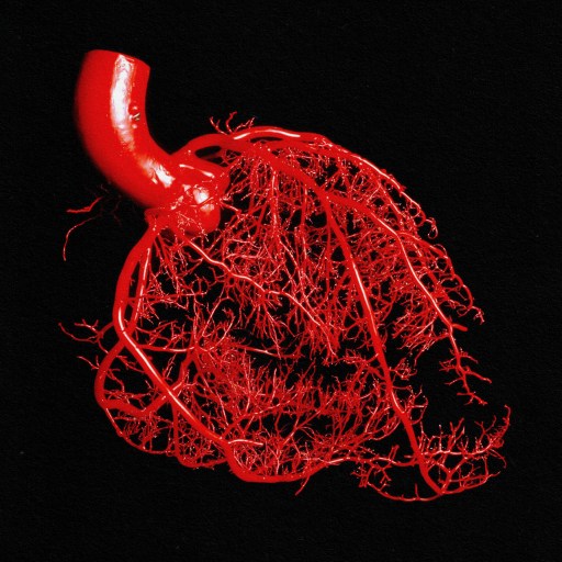 A lepodisiran image of a human heart on a black background.