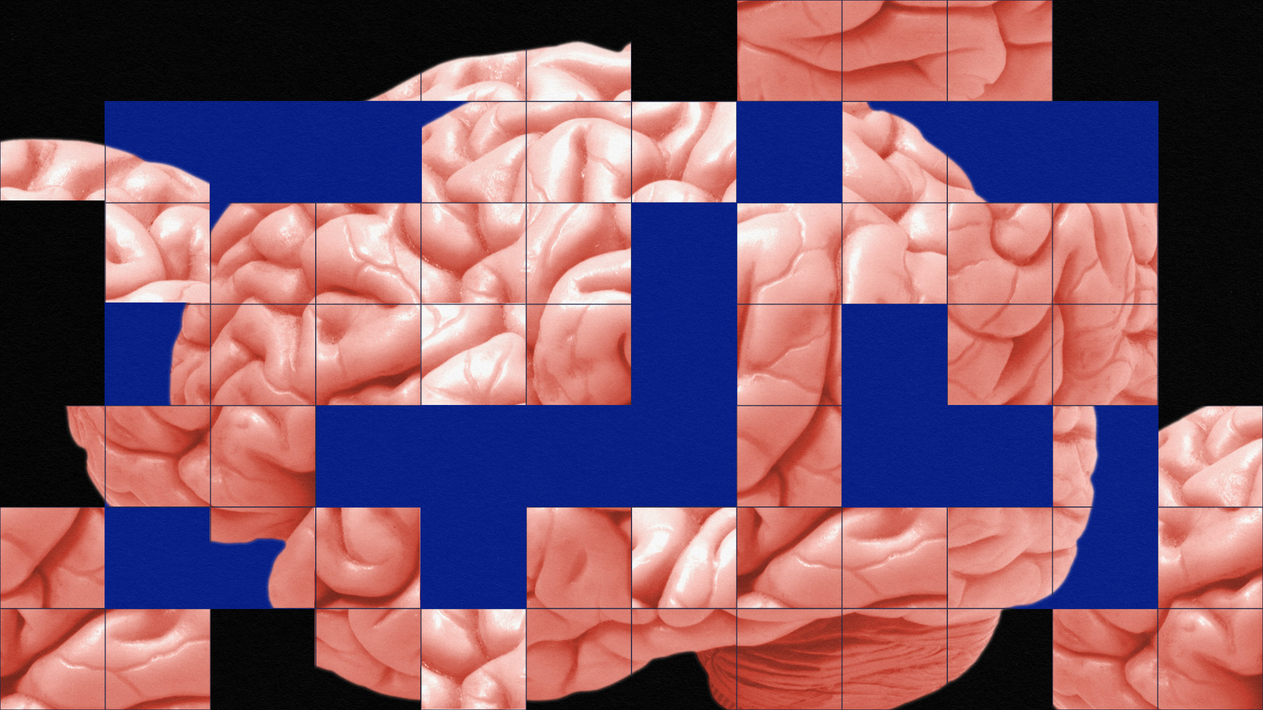 An image of a brain exhibiting the tetris effect.