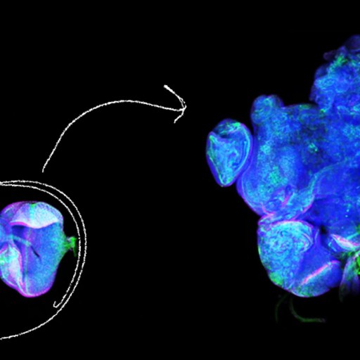 Fluorescence microscopy image showing a close-up of cells in vibrant blue and green colors, with an arrow indicating a magnified section.