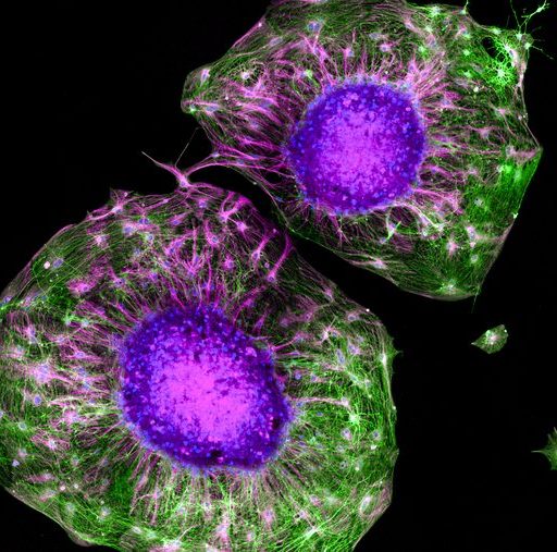 Two colorful cells with purple nuclei, green cell edges, and radiating filament structures against a black background.