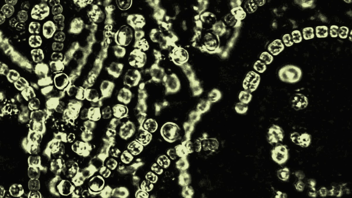 Microscopic view of green cyanobacteria chains forming spiral and linear patterns against a dark background, highlighting their role within the microbiome.