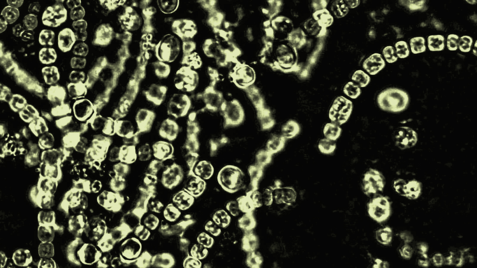 Microscopic view of green cyanobacteria chains forming spiral and linear patterns against a dark background, highlighting their role within the microbiome.