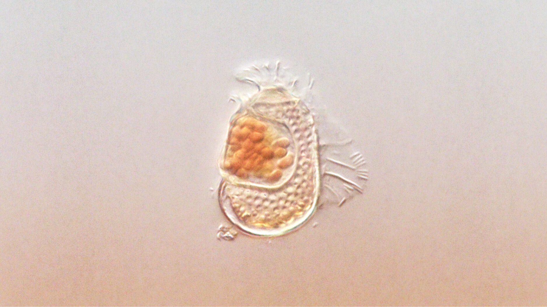 Microscopic view of a single-celled organism with a translucent body and clustered orange structures inside, set against a plain background.