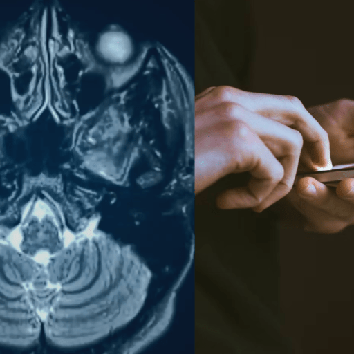 A split image showing a brain scan on the left and hands using a smartphone on the right.