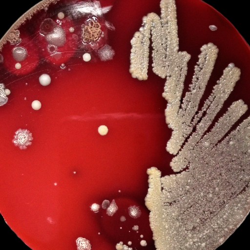 A petri dish with a red agar medium shows various colonies of bacteria growing, with dense streaks on the right and scattered colonies on the left.