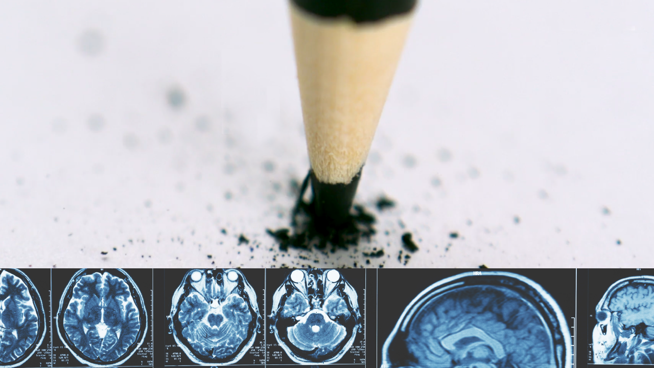 A pencil tip touching paper with scattered graphite, with a row of brain MRI scans shown below.