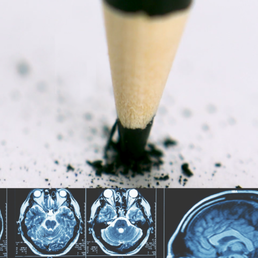 A pencil tip touching paper with scattered graphite, with a row of brain MRI scans shown below.