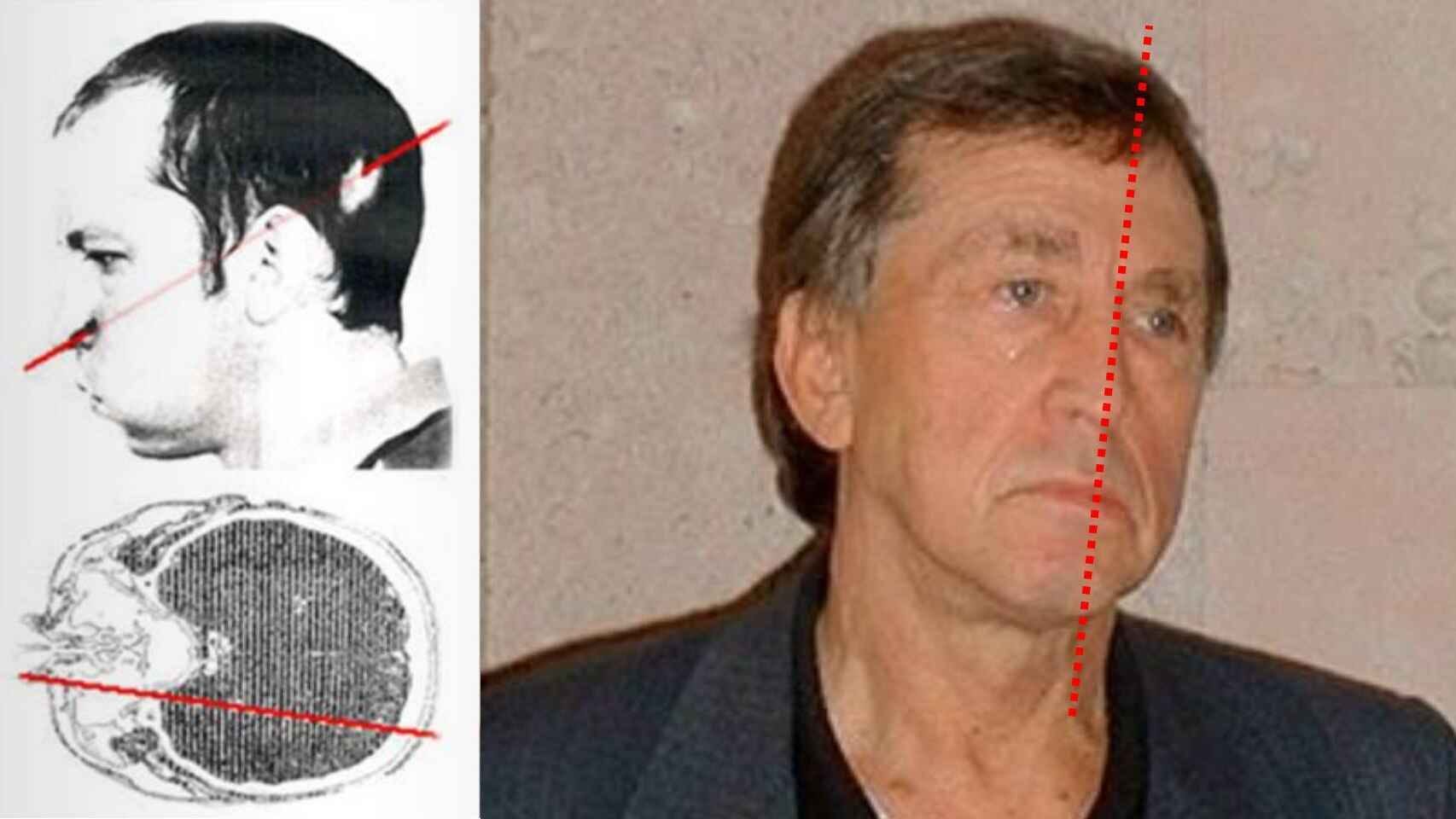 A man with facial asymmetry is shown next to medical diagrams, a red dashed line indicating the angle of his facial structure&mdash;possibly highlighting damage from cosmic ray exposure on the human face.
