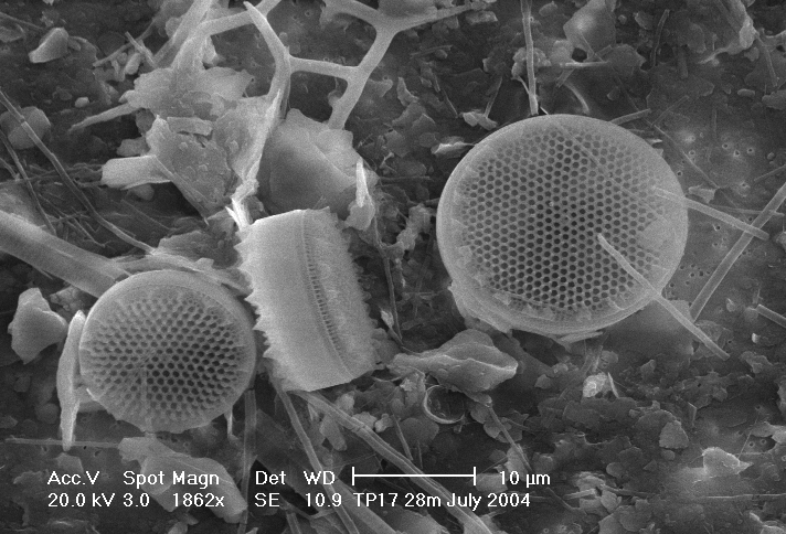 Scanning electron microscope image showing two round diatom shells with intricate perforated patterns among debris and other microscopic structures. Such images have sparked claims of extraterrestrial life, though 7 hurdles remain in proving this theory. Scale bar: 10 micrometers.